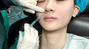 被吃瓜的医美网红叫什么,她是谁？为何引发热议？